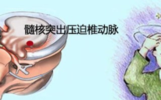 男生修电脑增高的方法教程（利用修电脑锻炼身体，男生也能增高）