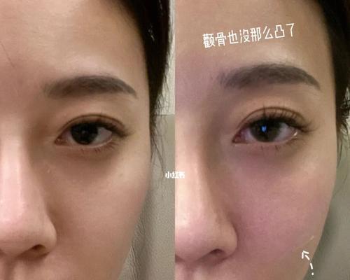 如何提升以脸上苹果机的使用体验（探索有效方法，让你的苹果机更出色）-第2张图片-数码深度