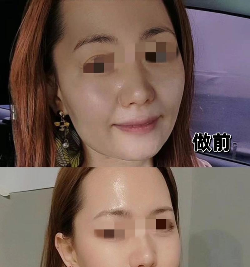 如何提升以脸上苹果机的使用体验（探索实用技巧，让你的苹果机更出众）-第1张图片-数码深度