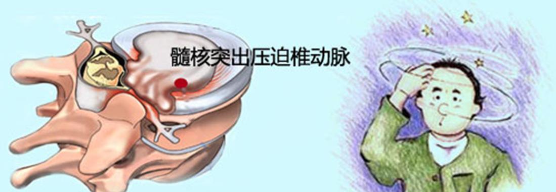 男生修电脑增高的方法教程（利用修电脑锻炼身体，男生也能增高）-第1张图片-数码深度